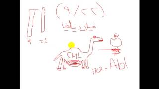 Pathology  drNafea  Chronic myeloid leukemia CML اورام [upl. by Hama]