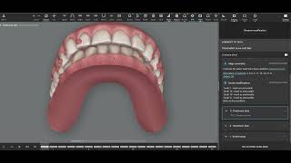 Invisalign Treatment Planning 39b [upl. by Margarette]