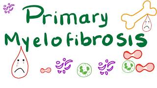 Primary Myelofibrosis PMF  Myeloproliferative Neoplasm Bone Marrow Fibrosis [upl. by Constance]