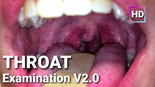 Throat Examination  ENT  Clinical Surgery in Bangla [upl. by Avla]