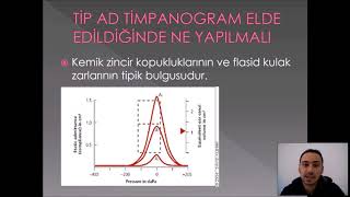 ODYOLOJİDE TİMPANOMETRİK TESTLER VE DEĞERLENDİRİLMELERİ [upl. by Denver]