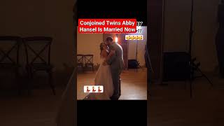 Abby Hensel One of the Conjoined Twins Gets Married viral abby trending [upl. by Eibbil]