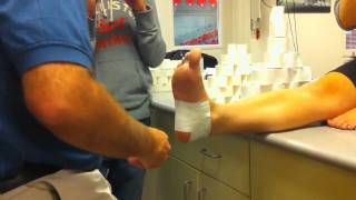 Acute Calcaneal Periostitis  Basket Weave Taping Technique [upl. by Middle]