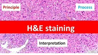 HE Staining Principle Procedure and Interpretation  Haematoxylin and Eosin Staining [upl. by Ymeon]