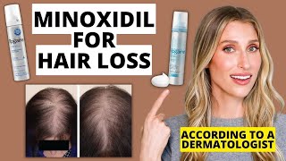 Dermatologist Explains How Minoxidil Works for Hair Loss How to Use Results amp More [upl. by Danyelle55]