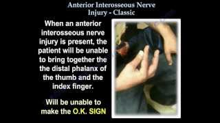 Anterior Interosseous Nerve Injury Classic  Everything You Need To Know  Dr Nabil Ebraheim [upl. by Ennovy]