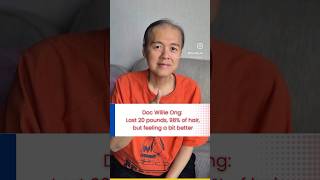 Doc Willie Ong Lost 20 pounds 98 of hair but feeling a bit better [upl. by Eibber57]