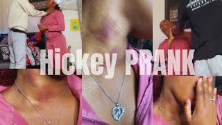 Hickey Prank On My Protective boyfriend got heated [upl. by Mandych]