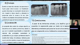 INGENIERÍA TISULAR EN LA REGENERACIÓN PULPAR DE DIENTES CON ÁPICE ABIERTO [upl. by Eet686]