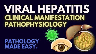 Viral Hepatitis I Pathophysiology Made Easy [upl. by Reffotsirk586]