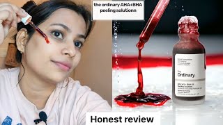 🔴Live result  sharing honest review of the ordinary ahabha peeling solution [upl. by Wonacott]