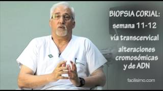 Embarazo biopsia corial  facilisimocom [upl. by Shig777]