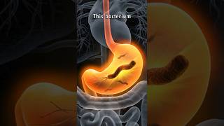 How Helicobacter Pylori Survives in your Stomach 🦠🥴 [upl. by Retxab]