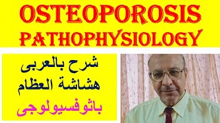 Osteoporosis Pathophysiology شرح بالعربى هشاشة العظام باثوفسيولوجى [upl. by Giralda]