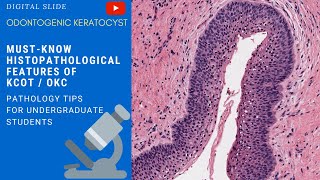 Odontogenic Keratocyst Histopathology [upl. by Nnylrac]