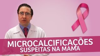 Microcalcificações suspeitas na mama  IMEB [upl. by Poirer]