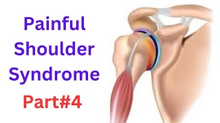 Painful shoulder syndrome Classification  Rotator cuff tear  Assesment  shoulder special tests [upl. by Yenor]