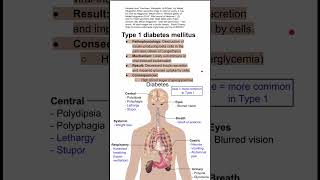 Type 1 diabetes mellitus [upl. by Kaine848]