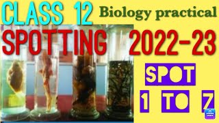 Class 12 biology practical  Spotting  how to do SPOTTING [upl. by Canute]