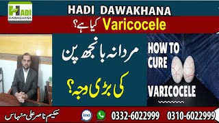 Varicocele Symptoms and Treatment  Varicocele Treatment Without Surgery  Testicle Pain ka ilaj [upl. by Eliath921]