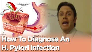 How To Diagnose An H Pylori Infection [upl. by Annahsar]