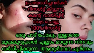 പാടുകളും കുരുവും മാറി മുഖം നിറം വക്കാൻ ആയുർവേദ ചൂർണം [upl. by Joceline]