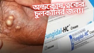 FungidalHC Creamত্বকের চুলকানিএকজিমাএবংঅন্ডকোষের চুলকানির জন্য খুবই উপকারি ক্রীম।medicine [upl. by Anyar59]