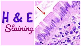 H amp E staining  Hematoxylin amp Eosin staining [upl. by Godbeare]