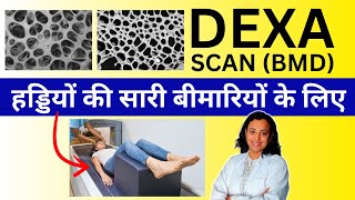 DEXA Scan Kya Hota Hai Bone Density Scan for Bone Disorders [upl. by Dunstan]