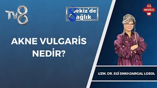 Akne Vulgaris Nedir  Uzm Dr Egi Enkhjargal Losol  8de Sağlık [upl. by Adala]