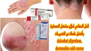 الحل النهائي لعلاج مشكل الصدفية بأفضل خلطة من الكريمات daivobetdiprolenedermaskin [upl. by Atiral]