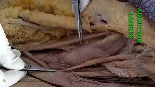 DISSECTION OF FRONT OF THIGH PART1 BY DR MITESH DAVE [upl. by Eey]