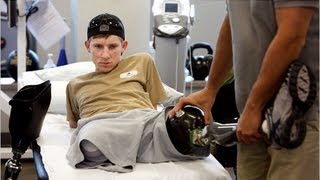 US soldier recovers after losing all four limbs [upl. by Herold]