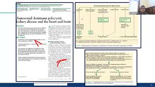 Tolvaptan for Autosomal dominant polycystic kidney disease [upl. by Diba]