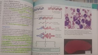 Chronic Myeloid Leukemia  SPECIAL PATHOLOGY [upl. by Jewell30]