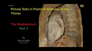 Picture Tests in Anatomy  Thorax  Mediastinum 2 [upl. by Ohara192]