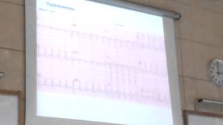 Dr Hany Gamal Hypokalemia 2  Hyperkalemia [upl. by Meyer332]