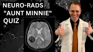 Neuroradiology quotAunt Minniequot Quiz [upl. by Hardi665]