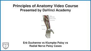 Erb Duchenne vs Klumpke Palsy vs Radial Nerve Palsy Cases Upper Limb Anatomy 14 of 18 [upl. by Lanita]