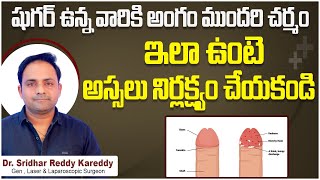 అంగం ముందరి చర్మం  What is Balanitis  Balanitis Treatment in Telugu  Treatment Range Hospital [upl. by Eirrehs295]