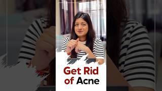 5 Habits to Get Rid of Acne  Get Rid of Acne [upl. by Yelssew27]