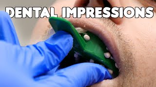 Dental Impressions amp Pouring Teeth Models [upl. by Chew155]