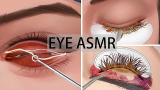 Eye ASMR lashes cleaningeye mucous removal animationremove eyelashes dirty makeup [upl. by Eerised172]