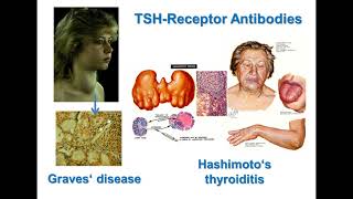 TSH Receptor Antibodies Nomenclature Functionality and Assay Comparison [upl. by Adar612]