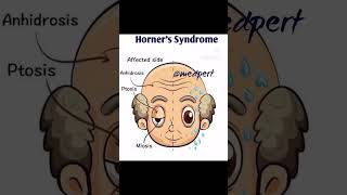 Horner syndrome mbbs usmle anatomy neuroscience biology studymotivation anatomy viralvideo [upl. by Cloe]