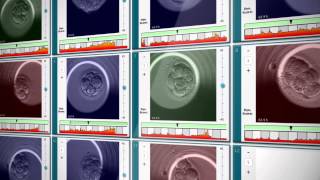 EmbryoScope® Timelapse System [upl. by Neitsabes]