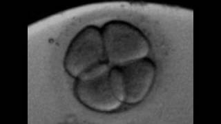 Rotation of the blastomeres at 4cells human embryoavi [upl. by Aisiat12]