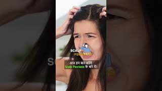 Scalp Psoriasis के लक्षण [upl. by Kikelia]