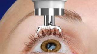 Unique DIATON Tonometry Through Eyelid  with Diaton Tonometer  Introduction  Description Part1 [upl. by Eiffe104]