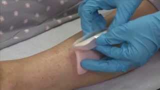 ALLEVYN Adhesive application to the leg [upl. by Anotyal]